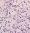 High mobility group protein HMG-I/HMG-Y antibody, orb10826, Biorbyt, Immunohistochemistry paraffin image 