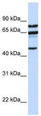 Protein Phosphatase 4 Regulatory Subunit 2 antibody, TA329514, Origene, Western Blot image 