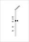 Putative gamma-glutamyltranspeptidase 3 antibody, M06875, Boster Biological Technology, Western Blot image 