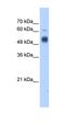 Glucosaminyl (N-Acetyl) Transferase 3, Mucin Type antibody, orb330309, Biorbyt, Western Blot image 