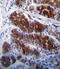 RAK antibody, 63-160, ProSci, Immunohistochemistry paraffin image 