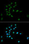 Proteasome Subunit Alpha 1 antibody, STJ25170, St John