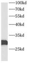 AU RNA Binding Methylglutaconyl-CoA Hydratase antibody, FNab00744, FineTest, Western Blot image 