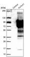 Kelch repeat and BTB domain-containing protein 10 antibody, PA5-54498, Invitrogen Antibodies, Western Blot image 
