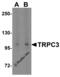 Short transient receptor potential channel 3 antibody, 3895, ProSci, Western Blot image 