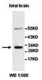 Aldo-Keto Reductase Family 7 Like (Gene/Pseudogene) antibody, orb77547, Biorbyt, Western Blot image 