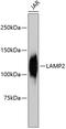 Lysosomal Associated Membrane Protein 2 antibody, 13-868, ProSci, Western Blot image 