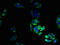 Transient Receptor Potential Cation Channel Subfamily M Member 2 antibody, A62494-100, Epigentek, Immunofluorescence image 