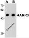 Arrestin 3 antibody, 7643, ProSci, Western Blot image 
