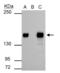 SWI/SNF Related, Matrix Associated, Actin Dependent Regulator Of Chromatin Subfamily C Member 1 antibody, GTX114777, GeneTex, Immunoprecipitation image 