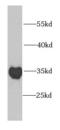 Proteasome Inhibitor Subunit 1 antibody, FNab06898, FineTest, Western Blot image 