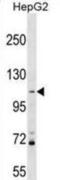 Proline And Serine Rich 1 antibody, abx029852, Abbexa, Western Blot image 