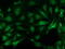 Phenylethanolamine N-Methyltransferase antibody, M02813-1, Boster Biological Technology, Immunofluorescence image 