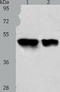Acyl-CoA Thioesterase 9 antibody, TA323401, Origene, Western Blot image 