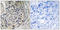 Solute Carrier Family 25 Member 12 antibody, LS-C119796, Lifespan Biosciences, Immunohistochemistry paraffin image 