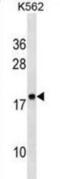 60S acidic ribosomal protein P2 antibody, abx034327, Abbexa, Western Blot image 