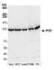 Importin-9 antibody, A305-475A, Bethyl Labs, Western Blot image 