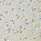 Dehydrogenase/Reductase 2 antibody, 22-229, ProSci, Immunohistochemistry frozen image 