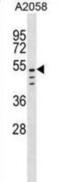 C-Type Lectin Domain Family 18 Member C antibody, abx030662, Abbexa, Western Blot image 