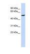 Zinc Finger Protein 154 antibody, NBP1-79273, Novus Biologicals, Western Blot image 