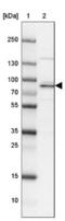Protein-Glucosylgalactosylhydroxylysine Glucosidase antibody, NBP1-93941, Novus Biologicals, Western Blot image 