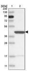 Inositol Polyphosphate-1-Phosphatase antibody, PA5-57777, Invitrogen Antibodies, Western Blot image 