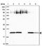 ADP-ribosylation factor-like protein 10B antibody, PA5-58531, Invitrogen Antibodies, Western Blot image 