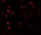 ATPase Phospholipid Transporting 11A antibody, 5855, ProSci Inc, Immunofluorescence image 
