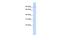 Zinc Finger CCHC-Type Containing 14 antibody, A15592, Boster Biological Technology, Western Blot image 