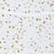 ETV1 antibody, 14-903, ProSci, Immunohistochemistry paraffin image 