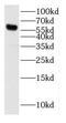 Cytochrome P450 Family 2 Subfamily J Member 2 antibody, FNab02161, FineTest, Western Blot image 