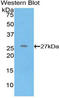 C-Reactive Protein antibody, LS-C300956, Lifespan Biosciences, Western Blot image 