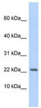 P2RX7 antibody, TA338780, Origene, Western Blot image 