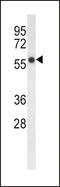 Fatty acid desaturase 2 antibody, LS-C165916, Lifespan Biosciences, Western Blot image 