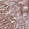 Testis And Ovary Specific PAZ Domain Containing 1 antibody, HPA047431, Atlas Antibodies, Immunohistochemistry frozen image 