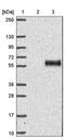 Keratocan antibody, PA5-58733, Invitrogen Antibodies, Western Blot image 