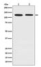 Drebrin 1 antibody, M05530, Boster Biological Technology, Western Blot image 