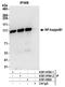 Nuclear Factor Kappa B Subunit 1 antibody, A301-819A, Bethyl Labs, Immunoprecipitation image 