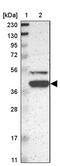 Kelch Domain Containing 8B antibody, PA5-52566, Invitrogen Antibodies, Western Blot image 