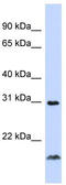 CD258 antibody, TA330337, Origene, Western Blot image 
