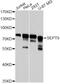 SEPT9 antibody, A8657, ABclonal Technology, Western Blot image 