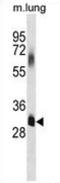 Elongation of very long chain fatty acids protein 7 antibody, AP51423PU-N, Origene, Western Blot image 