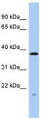 RWD Domain Containing 2A antibody, TA340213, Origene, Western Blot image 