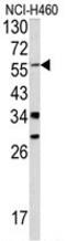 Yes Associated Protein 1 antibody, AP17844PU-N, Origene, Western Blot image 