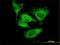 Eukaryotic translation initiation factor 5 antibody, H00001983-M01, Novus Biologicals, Immunocytochemistry image 