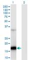 Zinc Finger CCHC-Type Containing 13 antibody, MA5-24539, Invitrogen Antibodies, Western Blot image 