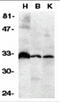 TNF Receptor Superfamily Member 6b antibody, 2140, ProSci, Western Blot image 