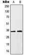 Homeobox protein Hox-A1 antibody, orb214046, Biorbyt, Western Blot image 