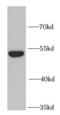 Krueppel-like factor 4 antibody, FNab04602, FineTest, Western Blot image 