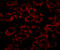 NPC Intracellular Cholesterol Transporter 1 antibody, A00428, Boster Biological Technology, Immunofluorescence image 